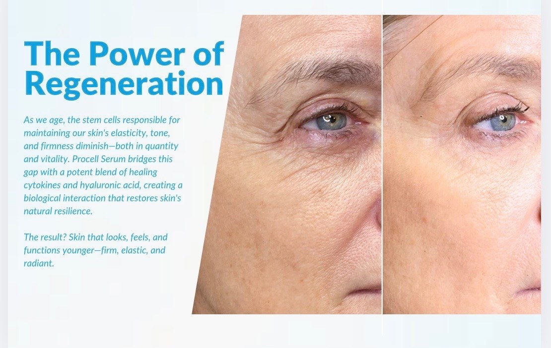 Procell regeneration before and after skin result graphic